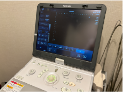 2Dエコー